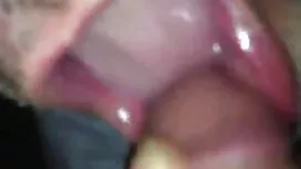 Hai trắng hummus phi ...